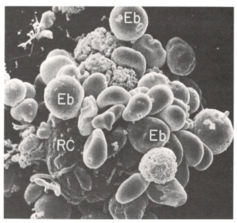 Microscopio che mostra eritroblasti