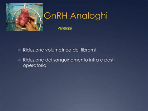Analoghi GnRH
