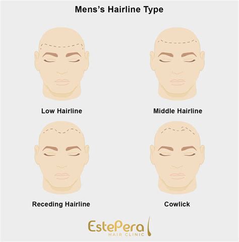 illustrazione di baby hair stilizzati lungo l'attaccatura dei capelli di una donna