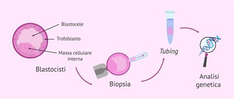 diagramma esplicativo del processo di biopsia embrionale