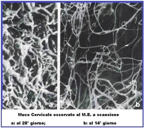 rappresentazione microscopica del muco cervicale fertile che facilita il passaggio degli spermatozoi