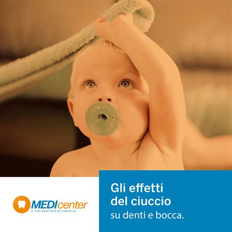 Effetti del ciuccio sullo sviluppo dei denti e della bocca