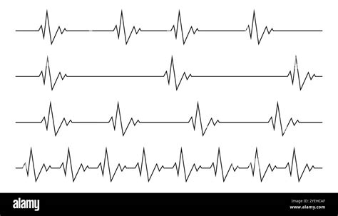 diagramma ritmico che confronta il battito straight con quello shuffle
