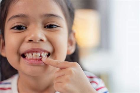 bambino sorridente con denti da latte