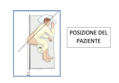 Illustrazione della posizione del paziente e del sito di iniezione per un'infiltrazione epidurale lombare