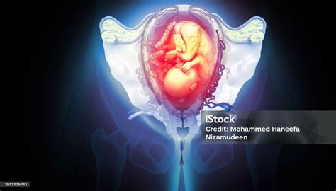 Feto nell'utero con infezione da Ureaplasma