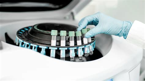 Test di laboratorio per la diagnosi di Mycoplasma/Ureaplasma