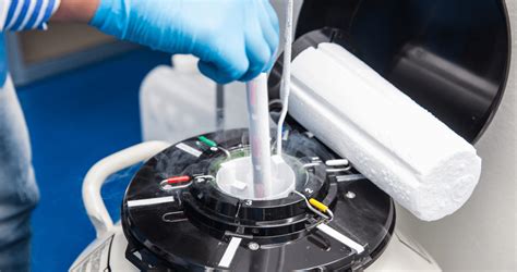 Sperm bank cryopreservation tanks