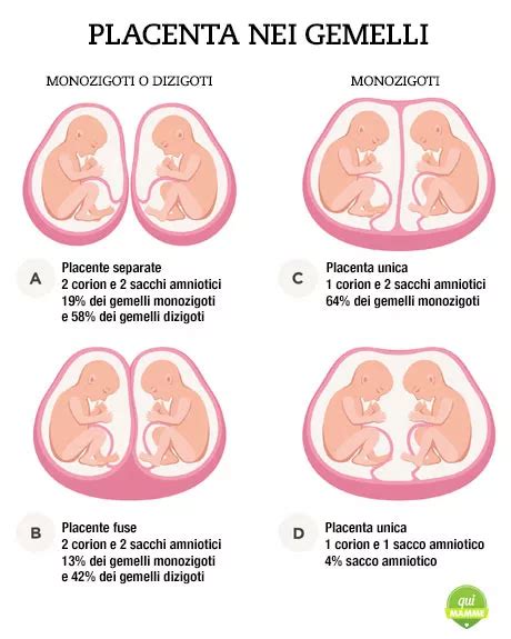 diagramma esplicativo che mostra i protocolli di monitoraggio in una gravidanza gemellare ad alto rischio