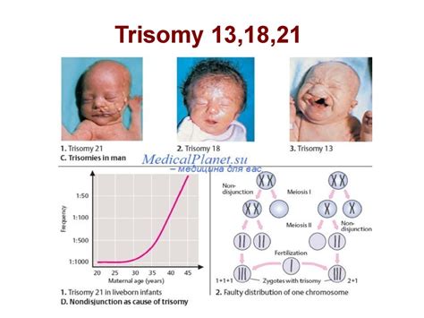 Schema anomalie cromosomiche (Trisomia 21, 18, 13)