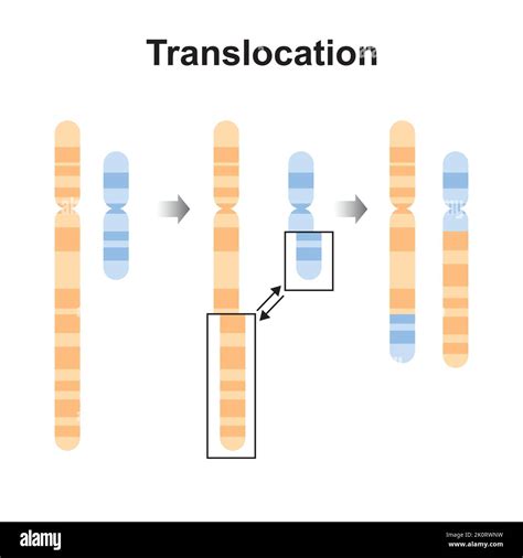 schema delle traslocazioni cromosomiche e impatto sul concepimento