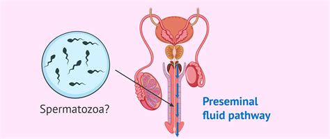Sperm in pre-ejaculatory fluid diagram