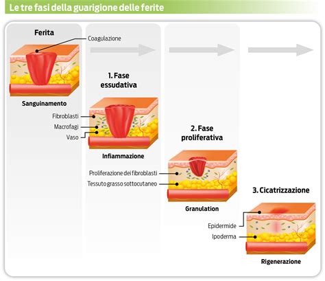 Fasi della guarigione di una ferita