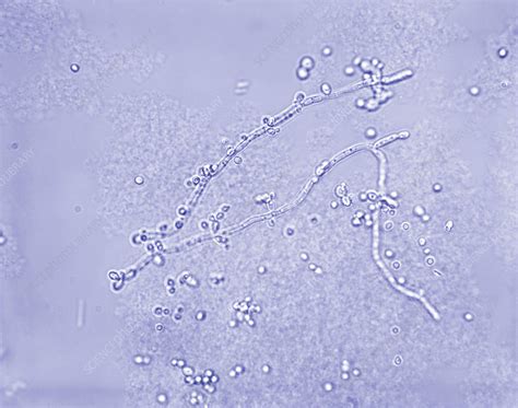 candida albicans al microscopio