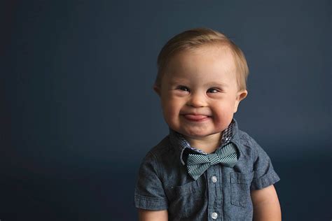 Bambino con Sindrome di Down