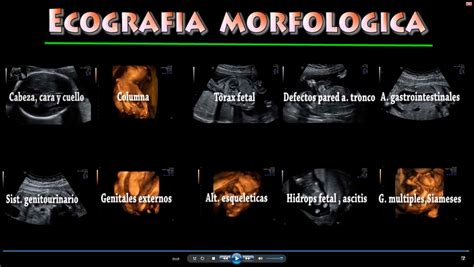 Ecografia Morfologica