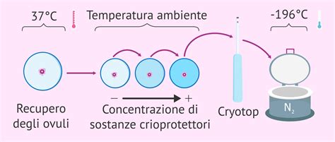 Diagramma del processo di vitrificazione degli ovociti