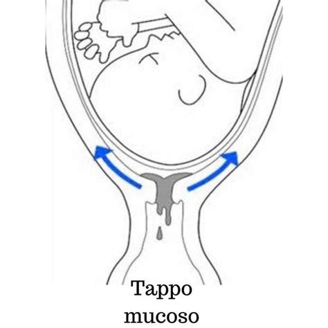 illustrazione anatomica semplificata dell'utero con sacco amniotico e tappo mucoso