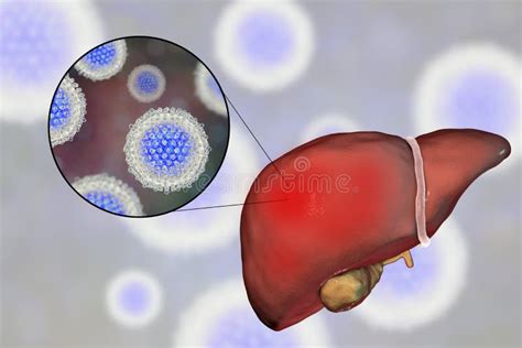 Microscopia elettronica del virus dell'Epatite C