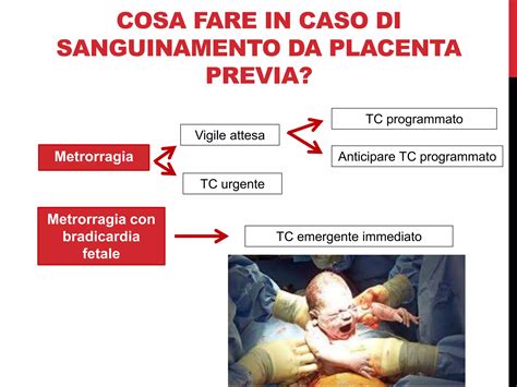 Infografica sull'emorragia post-partum